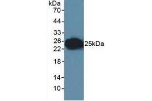 Western blot analysis of Human Lymphocyte Cells. (F11R 抗体  (AA 64-249))