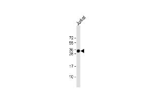 Anti-TMX1 Antibody (C-term) at 1:1000 dilution + Jurkat whole cell lysate Lysates/proteins at 20 μg per lane. (TMX1 抗体  (C-Term))