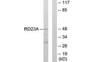Western blot analysis of extracts from LOVO cells, using RAD23A Antibody. (RAD23A 抗体  (AA 91-140))