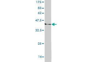 Western Blot detection against Immunogen (37. (RECQL2 抗体  (AA 1322-1432))