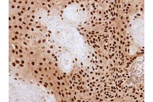 IHC-P Image Immunohistochemical analysis of paraffin-embedded SAS xenograft, using PDE6D, antibody at 1:500 dilution. (PDE6D 抗体  (full length))
