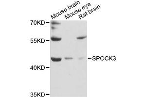 Western blot analysis of extracts of various cell lines, using SPOCK3 antibody (ABIN6292517) at 1:3000 dilution. (SPOCK3 抗体)