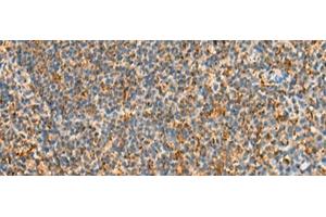 Immunohistochemistry of paraffin-embedded Human tonsil tissue using STK32C Polyclonal Antibody at dilution of 1:40(x200) (STK32C 抗体)