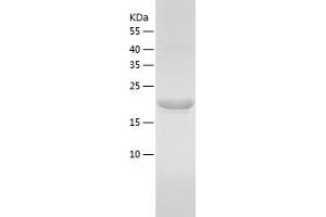 Western Blotting (WB) image for Interleukin 6 (IL6) (AA 25-211) protein (His tag) (ABIN7123611)