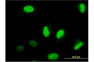 Immunofluorescence of monoclonal antibody to NFIB on HeLa cell. (NFIB 抗体  (AA 1-420))