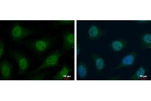 ICC/IF Image TrxR1 antibody detects TrxR1 protein at cytoplasm and nucleus by immunofluorescent analysis. (TXNRD1 抗体)