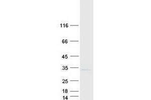 Validation with Western Blot