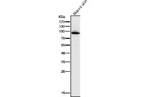 All lanes use the Antibody at 1:1K dilution for 1 hour at room temperature.