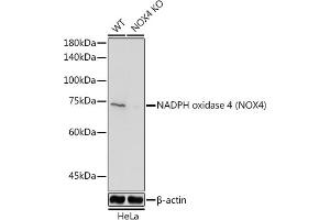Western blot analysis of extracts from normal (control) and NADPH oxidase 4 (NOX4) Rabbit pAb knockout (KO) HeLa cells, using NADPH oxidase 4 (NOX4) Rabbit pAb antibody (ABIN6128328, ABIN6144752, ABIN6144753 and ABIN6215143) at 1:1000 dilution. (NADPH Oxidase 4 抗体  (AA 328-578))