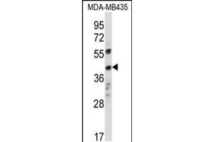 Western blot analysis in MDA-MB435 cell line lysates (35ug/lane). (OR8K1 抗体  (C-Term))