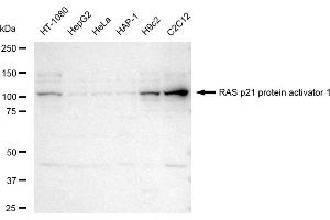 Western blotting analysis using RAS p21 protein activator 1 antibody (ABIN7800111). (Recombinant RACGAP1 抗体)