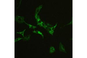 Immunohistochemistry (IHC) image for anti-Basigin (Ok Blood Group) (BSG) (AA 138-323) antibody (ABIN5518743)