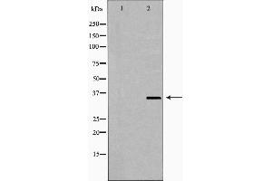 Western blot analysis of extracts of Jurkat using NUDT6 Antibody. (NUDT6 抗体  (Internal Region))