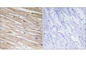 Immunohistochemistry analysis of paraffin-embedded human heart, using PEA-15 (Phospho-Ser104) Antibody. (PEA15 抗体  (pSer104))