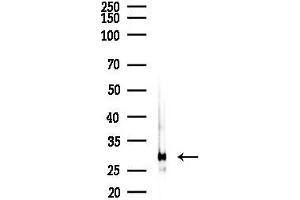 anti-NAD(P)H Dehydrogenase, Quinone 1 (NQO1) (C-Term) antibody