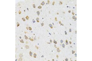 Immunohistochemistry of paraffin-embedded mouse brain using TGM2 antibody. (Transglutaminase 2 抗体)