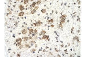 Immunohistochemistry (IHC) image for anti-Proteasome (Prosome, Macropain) 26S Subunit, Non-ATPase, 4 (Psmd4) (C-Term) antibody (ABIN2779578)