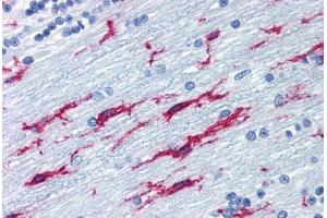 Human Brain, Cerebellum (formalin-fixed, paraffin-embedded) stained with ITGB2 antibody ABIN298664 at 10 ug/ml followed by biotinylated anti-mouse IgG secondary antibody ABIN481714, alkaline phosphatase-streptavidin and chromogen. (Integrin beta 2 抗体)