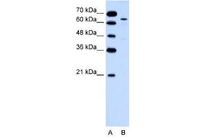 KRT2A antibody used at 0. (Keratin 2 抗体  (Middle Region))