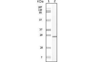 Western blot analysis using C-kit mouse mAb against truncated C-kit recombinant protein. (KIT 抗体)