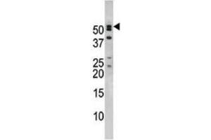 Western Blotting (WB) image for anti-Nucleoporin 50kDa (NUP50) antibody (ABIN2995223) (NUP50 抗体)