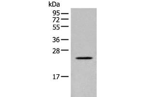 Western blot analysis of Human placenta tissue lysate using CARD16 Polyclonal Antibody at dilution of 1:800 (CARD16 抗体)