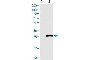 Western blot analysis of Lane 1: Negative control (vector only transfected HEK293T lysate), Lane 2: Over-expression Lysate (Co-expressed with a C-terminal myc-DDK tag (~3. (PCNP 抗体)
