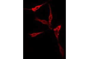 Immunofluorescence (fixed cells) (IF/ICC) image for anti-Synuclein, gamma (Breast Cancer-Specific Protein 1) (SNCG) (C-Term) antibody (ABIN6265207)