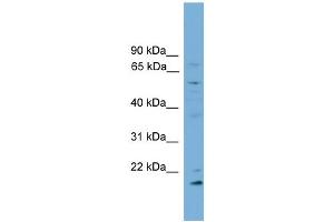 Western Blotting (WB) image for anti-Cytochrome P450, Family 2, Subfamily R, Polypeptide 1 (CYP2R1) (Middle Region) antibody (ABIN2783924)