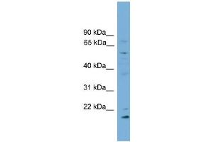 WB Suggested Anti-CYP2R1 Antibody Titration:  0. (CYP2R1 抗体  (Middle Region))
