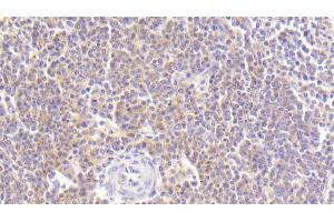 Detection of MDC in Human Spleen Tissue using Polyclonal Antibody to Macrophage Derived Chemokine (MDC) (CCL22 抗体  (AA 25-93))