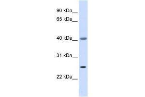 ADA antibody used at 1 ug/ml to detect target protein. (ADA 抗体  (Middle Region))