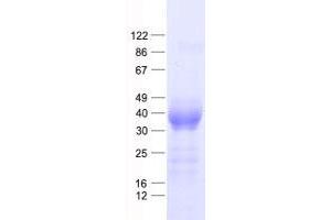 Western Blotting (WB) image for Chitinase, Acidic (CHIA) protein (His tag) (ABIN2714649)