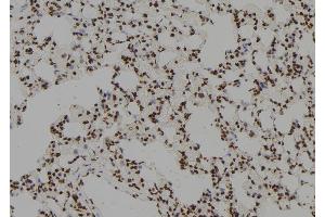 ABIN6279634 at 1/100 staining Rat lung tissue by IHC-P. (ZCCHC17 抗体  (Internal Region))