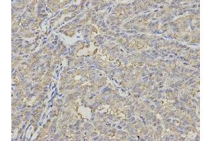 Immunohistochemistry (IHC) image for anti-Proteasome (Prosome, Macropain) 26S Subunit, Non-ATPase, 7 (PSMD7) antibody (ABIN1876544) (PSMD7 抗体)