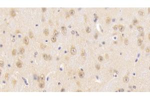 Detection of SNUPN1 in Mouse Cerebrum Tissue using Polyclonal Antibody to Snurportin 1 (SNUPN1) (Snurportin 1 抗体  (AA 1-329))