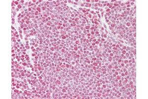 Anti-TARDBP antibody IHC of human thymus. (TARDBP 抗体  (AA 252-301))