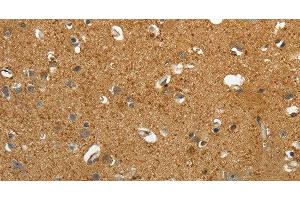 Immunohistochemistry of paraffin-embedded Human brain tissue using AKAP12 Polyclonal Antibody at dilution 1:40 (AKAP12 抗体)