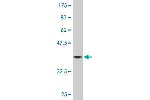 Western Blot detection against Immunogen (36. (CAMKK1 抗体  (AA 2-100))