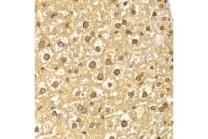 Immunohistochemistry of paraffin-embedded mouse liver using PYCARD antibody (ABIN5998640) at dilution of 1/100 (40x lens). (PYCARD 抗体)