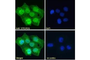 ABIN185681 Immunofluorescence analysis of paraformaldehyde fixed A431 cells, permeabilized with 0. (GTF2IRD1 抗体  (Internal Region))