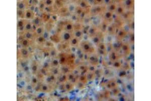 Used in DAB staining on fromalin fixed paraffin-embedded liver tissue (GLN1 抗体  (AA 1-373))