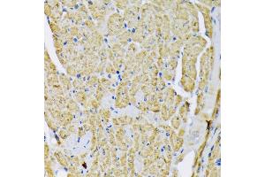 Immunohistochemistry of paraffin-embedded mouse heart using Hexokinase II antibody (ABIN3021255, ABIN3021256, ABIN3021257 and ABIN6214088) at dilution of 1:200 (40x lens).