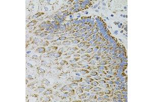 Immunohistochemistry of paraffin-embedded human esophagus using EPO antibody. (EPO 抗体)