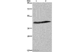 Western blot analysis of Human placenta tissue and HepG2 cell, using CSF2RA Polyclonal Antibody at dilution of 1:250 (CSF2RA 抗体)