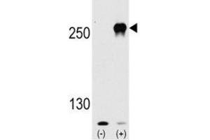 Western blot analysis of mTOR antibody and 293 cell lysate (2 ug/lane) either nontransfected (Lane 1) or transiently transfected with the mTOR gene (2). (MTOR 抗体  (AA 2459-2488))