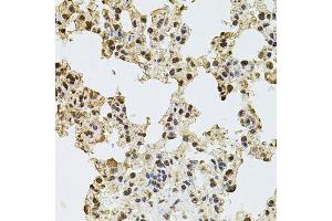 Immunohistochemistry of paraffin-embedded rat lung using ZNF408 antibody. (ZNF408 抗体  (AA 471-720))