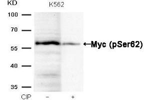 Western blot analysis of extracts from K562 cells, treated with calf intestinal phosphatase (CIP), using Myc (Phospho-Ser62) Antibody. (c-MYC 抗体  (pSer62))