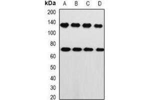 Western blot analysis of PRKG1 expression in A549 (A), PC3 (B), mouse lung (C), mouse heart (D) whole cell lysates. (PRKG1 抗体)
