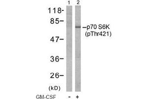 Image no. 2 for anti-Ribosomal Protein S6 Kinase, 70kDa, Polypeptide 1 (RPS6KB1) (pThr421) antibody (ABIN197014) (RPS6KB1 抗体  (pThr421))
